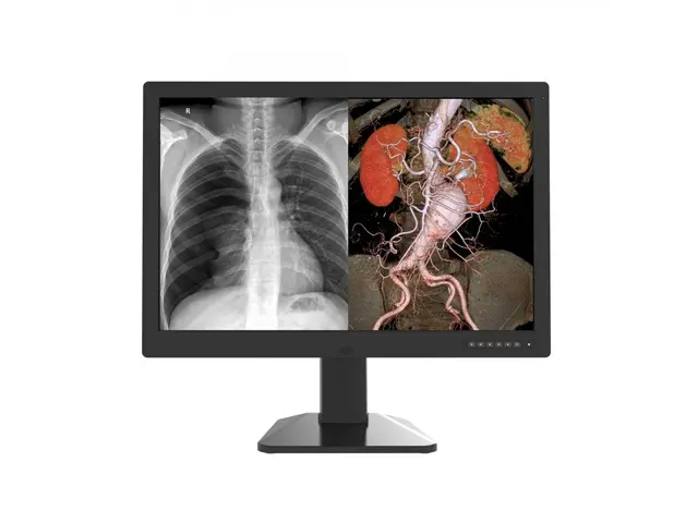 Цветные медицинские мониторы 30" 6 МП Jusha C61